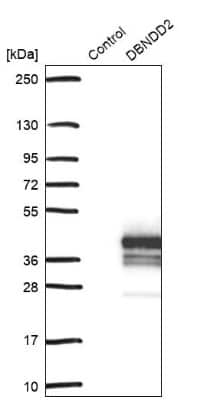 Western Blot: DBNDD2 Antibody [NBP1-91819]