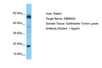 Western Blot: DBNDD2 Antibody [NBP2-82797]