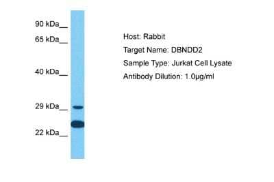 Western Blot: DBNDD2 Antibody [NBP2-82804]