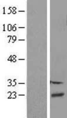 Western Blot: DBNDD2 Overexpression Lysate [NBP2-09250]