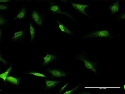 Immunocytochemistry/ Immunofluorescence: DBPA Antibody [H00008531-B01P]