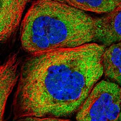 Immunocytochemistry/ Immunofluorescence: DBPA Antibody [NBP1-88049]