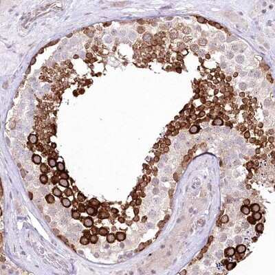 Immunohistochemistry-Paraffin: DBPA Antibody [NBP1-88049]