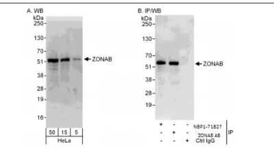 Immunoprecipitation: DBPA Antibody [NBP1-71827]