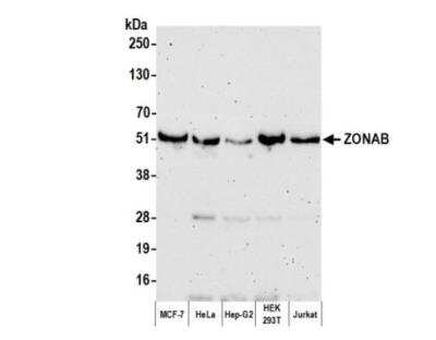 Western Blot: DBPA Antibody [NBP1-71827]