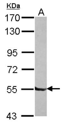 Western Blot: DBR1 Antibody [NBP2-16104]