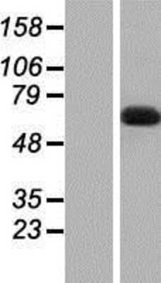 Western Blot: DBR1 Overexpression Lysate [NBP2-07069]