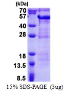 SDS-PAGE: Recombinant Human DBR1 His Protein [NBP2-22991]