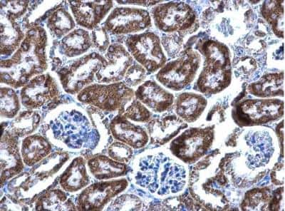Immunohistochemistry-Paraffin: DBT Antibody [NBP1-31760]