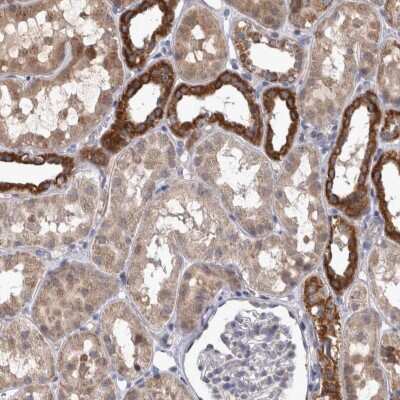 Immunohistochemistry-Paraffin: DBT Antibody [NBP1-85963]