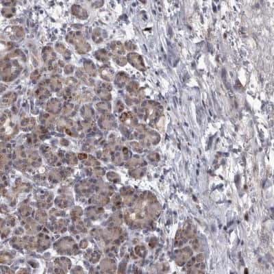 Immunohistochemistry-Paraffin: DBT Antibody [NBP1-85963]