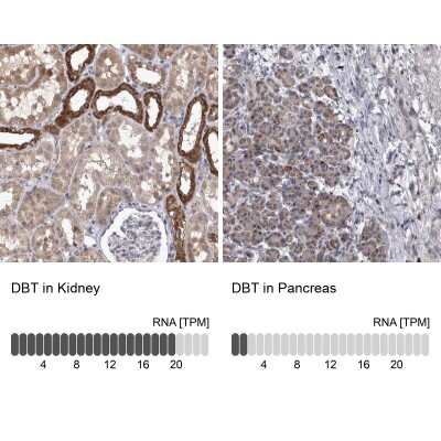 Immunohistochemistry-Paraffin: DBT Antibody [NBP1-85963]