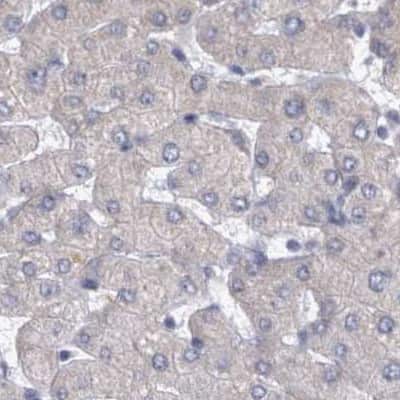 Immunohistochemistry-Paraffin: DBT Antibody [NBP1-85963]