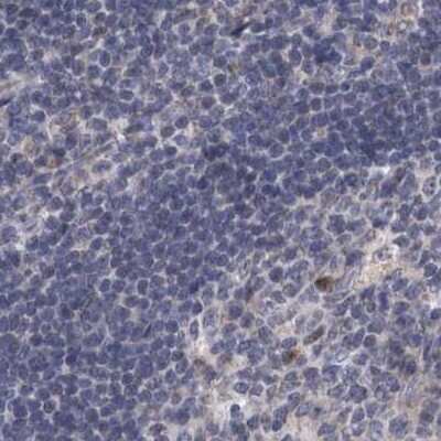Immunohistochemistry-Paraffin: DBT Antibody [NBP1-85963]