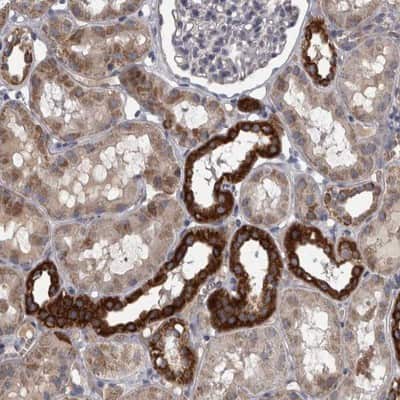 Immunohistochemistry-Paraffin: DBT Antibody [NBP1-85964]
