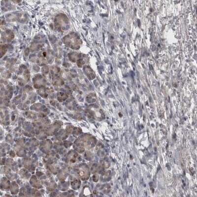 Immunohistochemistry-Paraffin: DBT Antibody [NBP1-85964]