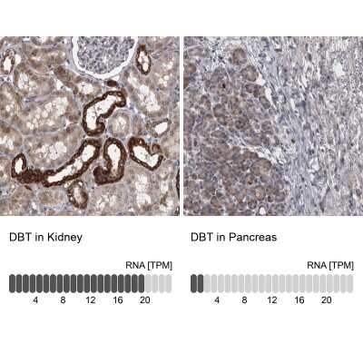Immunohistochemistry-Paraffin: DBT Antibody [NBP1-85964]