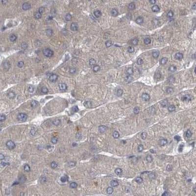 Immunohistochemistry-Paraffin: DBT Antibody [NBP1-85964]