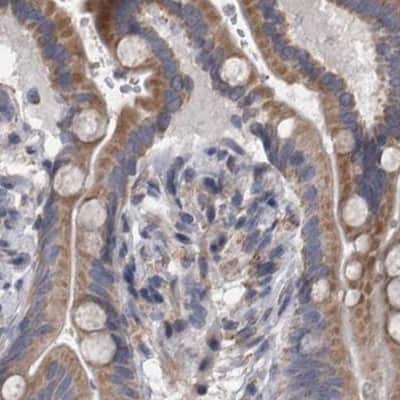 Immunohistochemistry-Paraffin: DBT Antibody [NBP1-85964]
