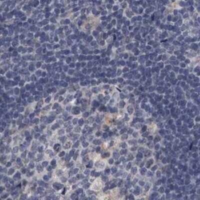 Immunohistochemistry-Paraffin: DBT Antibody [NBP1-85964]