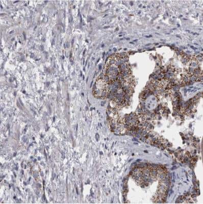 Immunohistochemistry-Paraffin: DBT Antibody [NBP1-89522]