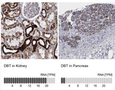 Immunohistochemistry-Paraffin: DBT Antibody [NBP1-89522]