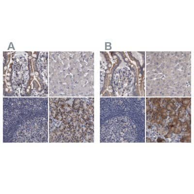 Immunohistochemistry-Paraffin: DBT Antibody [NBP1-89522]