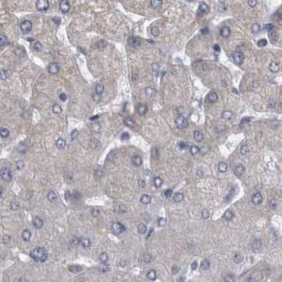 Immunohistochemistry-Paraffin: DBT Antibody [NBP1-89522]