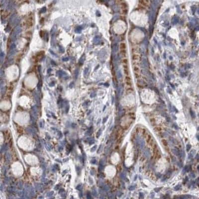Immunohistochemistry-Paraffin: DBT Antibody [NBP1-89522]