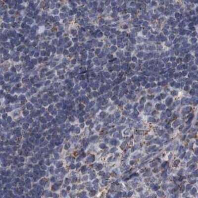 Immunohistochemistry-Paraffin: DBT Antibody [NBP1-89522]