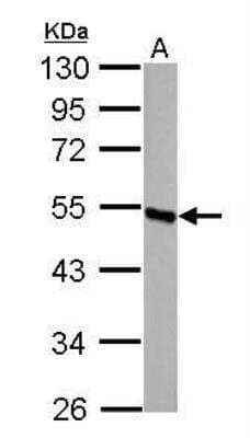 Western Blot: DBT Antibody [NBP1-31760]