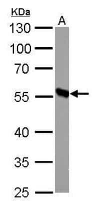Western Blot: DBT Antibody [NBP1-31760]
