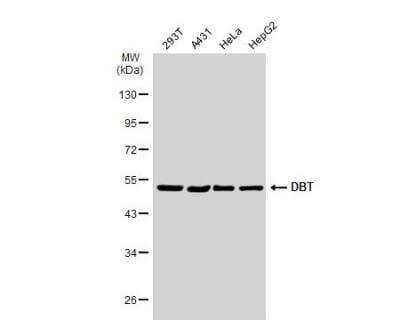 Western Blot: DBT Antibody [NBP1-31760]