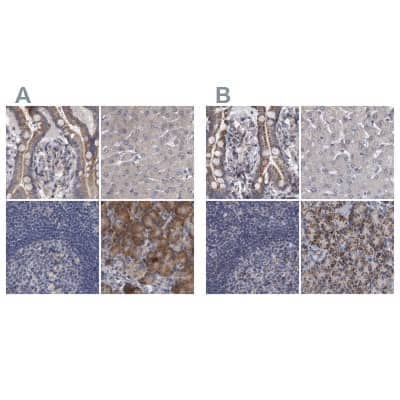 Western Blot: DBT Antibody [NBP1-85964]