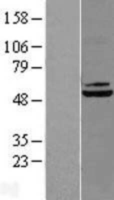 Western Blot: DBT Overexpression Lysate [NBL1-09735]