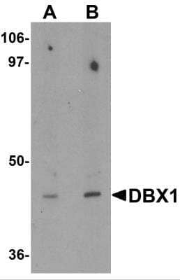 Western Blot: DBX1 AntibodyBSA Free [NBP2-81711]