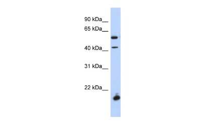 Western Blot: DBX1 Antibody [NBP2-82806]