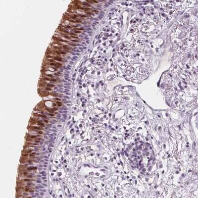 Immunohistochemistry: DBX2 Antibody [NBP2-39067]