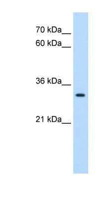 Western Blot: DBX2 Antibody [NBP1-79212]