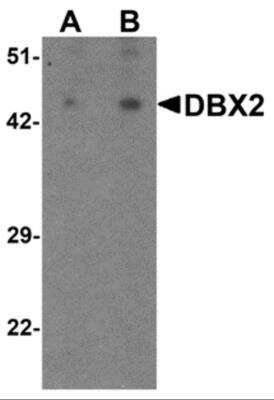 Western Blot: DBX2 AntibodyBSA Free [NBP2-82083]