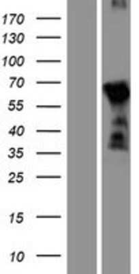 Western Blot: DBX2 Overexpression Lysate [NBP2-08865]