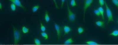 Immunocytochemistry/ Immunofluorescence: DC-LAMP Antibody (007) [NBP2-89553]