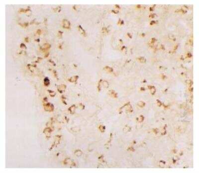 Immunohistochemistry: DC-LAMP Antibody (1006F7.05) [DDX0192P-100]