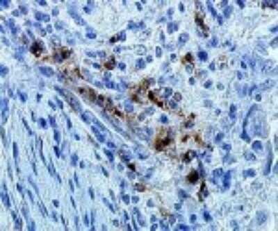 Immunohistochemistry: DC-LAMP Antibody (1010E1.01) [DDX0191P-100]