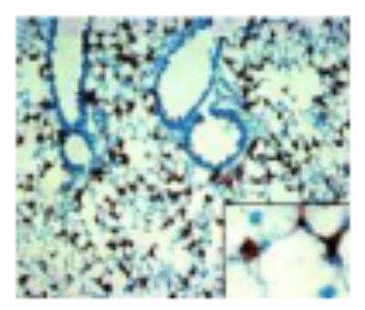 Immunohistochemistry: DC-LAMP Antibody (1010E1.01) [DDX0191P-100]
