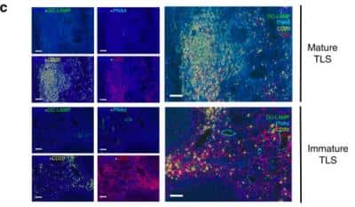 Immunohistochemistry: DC-LAMP Antibody (1010E1.01) [DDX0191P-100]