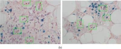 Immunohistochemistry: DC-LAMP Antibody (104G4) [DDX0190P-100]