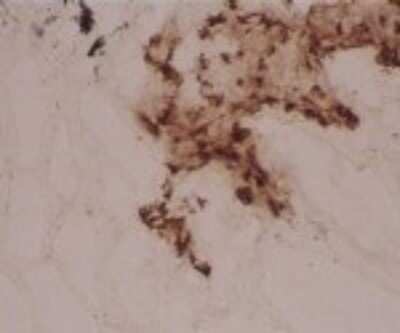 Immunohistochemistry-Frozen: DC-LAMP Antibody (104G4) [DDX0190P-100]