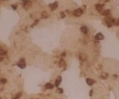 Immunohistochemistry: DC-LAMP Antibody (109G3) [DDX0193P-100]