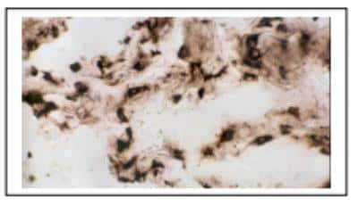 Immunohistochemistry: DC-LAMP Antibody (109G3) [DDX0193P-100]